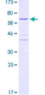 Recombinant Human HDGF protein