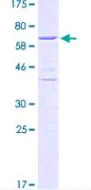 SDS-PAGE - Recombinant Human HDGF protein (AB132259)