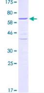 SDS-PAGE - Recombinant Human HDGF protein (GST tag N-Terminus) (AB132259)