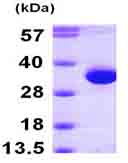 SDS-PAGE - Recombinant Human HDHD2 protein (AB101940), expandable thumbnail