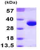 SDS-PAGE - Recombinant Human HDHD2 protein (His tag N-Terminus) (AB101940)