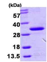 SDS-PAGE - Recombinant Human HDHD3 protein (AB104901)