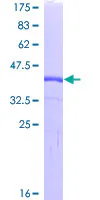 SDS-PAGE - Recombinant Human HE4 protein (AB132299)