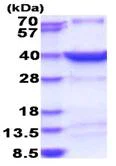 SDS-PAGE - Recombinant Human Heat Shock Factor 2 Binding Protein (His tag N-Terminus) (AB183220)