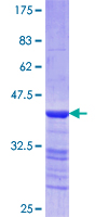 SDS-PAGE - Recombinant Human heavy chain Myosin/MYH3 protein (GST tag N-Terminus) (AB114308)