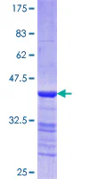 SDS-PAGE - Recombinant Human heavy chain Myosin/MYH3 protein (GST tag N-Terminus) (AB114308)