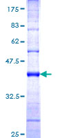 Recombinant Human HECTD1 protein