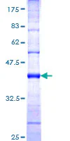 SDS-PAGE - Recombinant Human HECTD1 protein (GST tag N-Terminus) (AB161805)