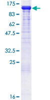 Recombinant Human HEF1/NEDD-9 protein