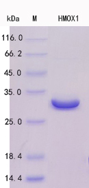 SDS-PAGE - Recombinant Human Heme Oxygenase 1 Protein Standard (His tag) (AB316421), expandable thumbnail