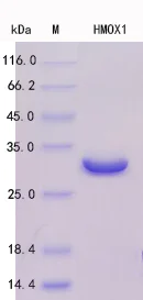 SDS-PAGE - Recombinant Human Heme Oxygenase 1 Protein Standard (His tag) (AB316421)