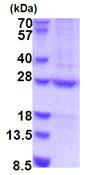 SDS-PAGE - Recombinant Human HEMK2/N6AMT1 protein (AB187466)