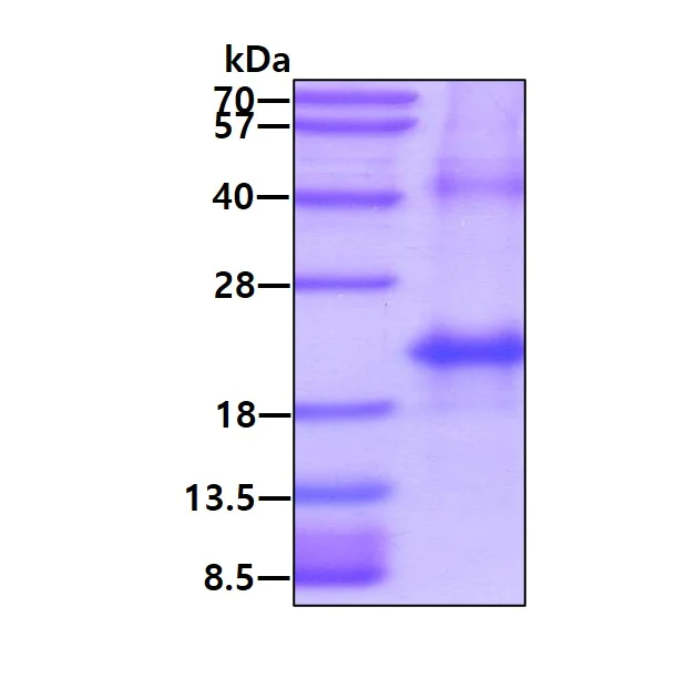 SDS-PAGE - Recombinant Human Hemoglobin subunit alpha protein (denatured) (DDDDK tag N-Term + His tag N-Term) (AB131697)