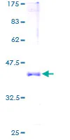 SDS-PAGE - Recombinant Human Hemoglobin subunit alpha protein (GST tag N-Terminus) (AB158638)