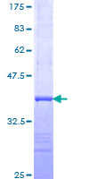 SDS-PAGE - Recombinant Human Hemoglobin subunit beta protein (AB158639)