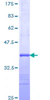 SDS-PAGE - Recombinant Human Hemoglobin subunit beta protein (GST tag N-Terminus) (AB158639)