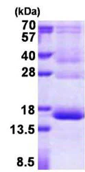 SDS-PAGE - Recombinant Human Hemoglobin subunit gamma-1 protein (His tag N-Terminus) (AB156712)