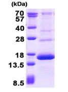 SDS-PAGE - Recombinant Human Hemoglobin subunit gamma 2 protein (AB139782)