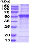SDS-PAGE - Recombinant Human Hemopexin protein (denatured) (His tag N-Terminus) (AB177679)