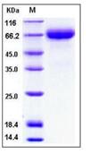 SDS-PAGE - Recombinant Human Hemopexin protein (His tag) (AB276330)