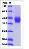 SDS-PAGE - Recombinant Human HEPACAM protein (His tag) (AB276708)