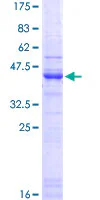 SDS-PAGE - Recombinant Human Heparan Sulfate Proteoglycan 2/Perlecan protein (GST tag N-Terminus) (AB114285)