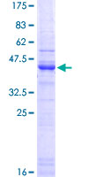 SDS-PAGE - Recombinant Human Heparan Sulfate Proteoglycan 2/Perlecan protein (Tagged) (AB114285)