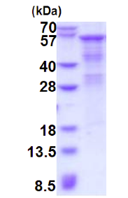 SDS-PAGE - Recombinant Human Heparanase 1 protein (denatured) (AB181927), expandable thumbnail