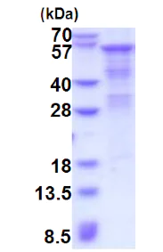 SDS-PAGE - Recombinant Human Heparanase 1 protein (denatured) (His tag N-Terminus) (AB181927)