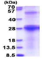 SDS-PAGE - Recombinant Human Hepatitis C Virus E2 protein (denatured) (AB180302)