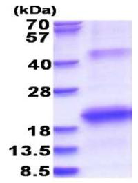SDS-PAGE - Recombinant Human Hepatitis C virus NS5B protein (AB180323), expandable thumbnail