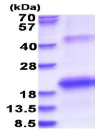 SDS-PAGE - Recombinant Human Hepatitis C virus NS5B protein (His-DDDDK tag N-Terminus) (AB180323)