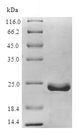 SDS-PAGE - Recombinant Human herpesvirus EBV Early Antigen Restricted Ea-R p85 protein (His tag) (AB224863)