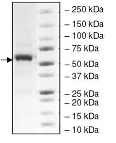 SDS-PAGE - Recombinant Human HEXA protein (AB198482), expandable thumbnail