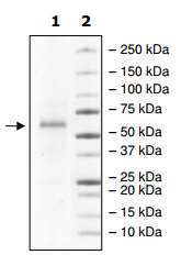 SDS-PAGE - Recombinant Human HEXB protein (AB198424), expandable thumbnail