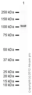 Western blot - Recombinant human Hexokinase 1 protein (AB85918)