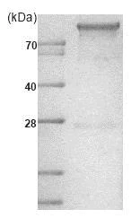 SDS-PAGE - Recombinant human Hexokinase 1 protein (His tag N-Terminus) (AB85918)