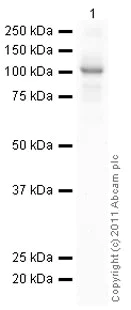 Western blot - Recombinant human Hexokinase 1 protein (His tag N-Terminus) (AB85918)