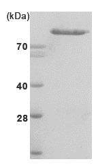 SDS-PAGE - Recombinant human Hexokinase II protein (His tag) (AB85920), expandable thumbnail