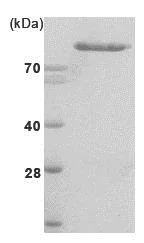 SDS-PAGE - Recombinant human Hexokinase II protein (His tag N-Terminus) (AB85920)