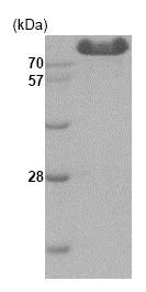 SDS-PAGE - Recombinant Human Hexokinase Type III/HK3 protein (His tag N-Terminus) (AB85921)