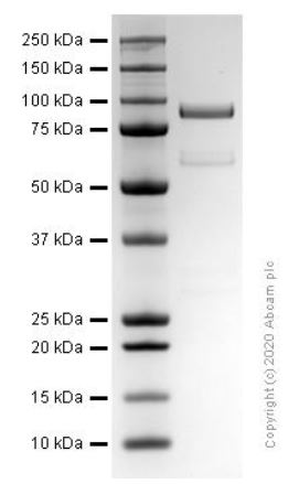 SDS-PAGE - Recombinant human HGF protein (Active) (AB259401), expandable thumbnail