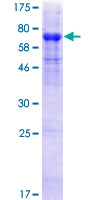 SDS-PAGE - Recombinant Human HHLA2 protein (AB161322)