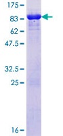 SDS-PAGE - Recombinant Human hHR23A protein (AB152648), expandable thumbnail