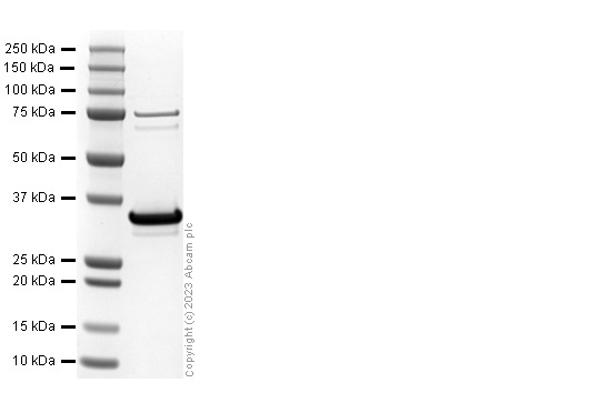 SDS-PAGE - Recombinant Human HIF-1 alpha protein (His-tag) (AB309958), expandable thumbnail
