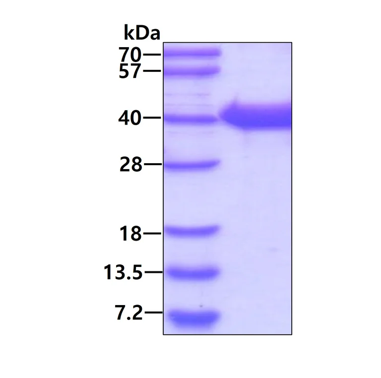 SDS-PAGE - Recombinant Human HIF-1 alpha protein (Tag Free) (AB48734)