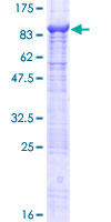 SDS-PAGE - Recombinant Human HIF Prolyl Hydroxylases protein (AB162816), expandable thumbnail