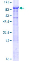 SDS-PAGE - Recombinant Human HIF Prolyl Hydroxylases protein (GST tag N-Terminus) (AB162816)