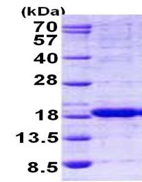 SDS-PAGE - Recombinant Human HINT2 protein (AB156323)