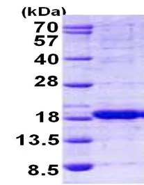 SDS-PAGE - Recombinant Human HINT2 protein (His tag N-Terminus) (AB156323)